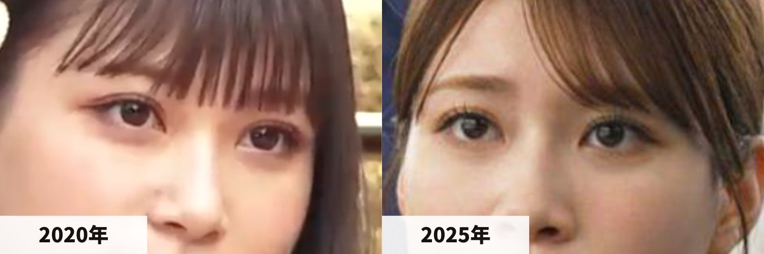 2020年と2025年のめるるさんの目元の比較画像