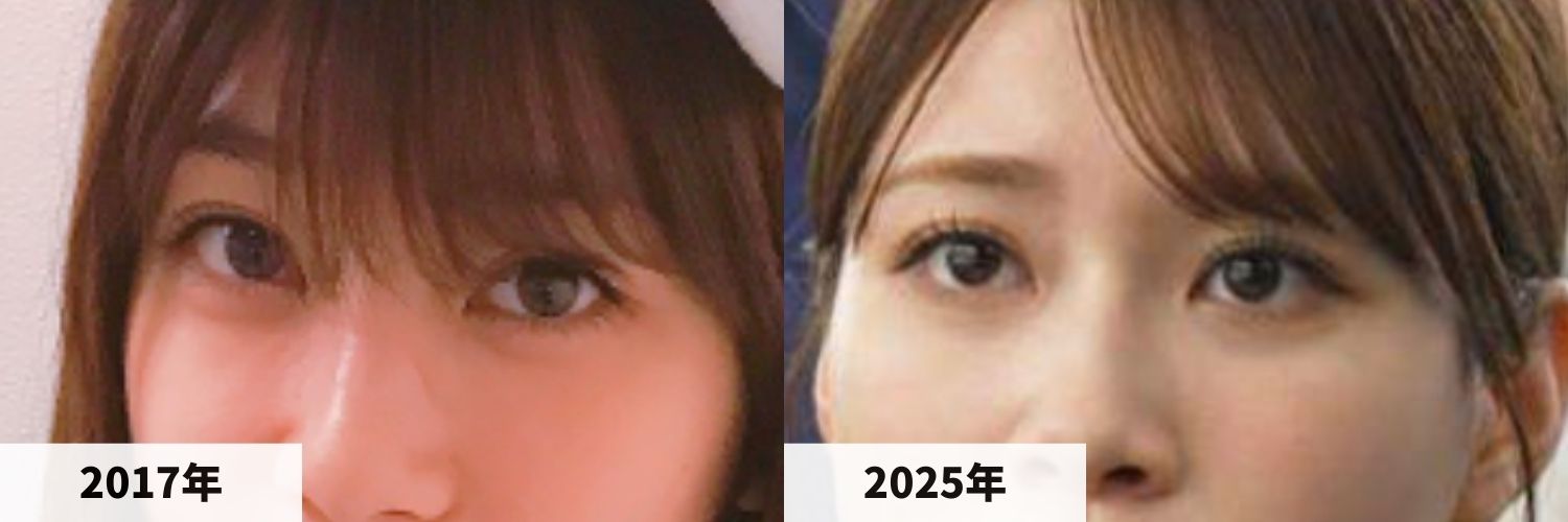 2017年と2025年のめるるさんの目元の比較画像
