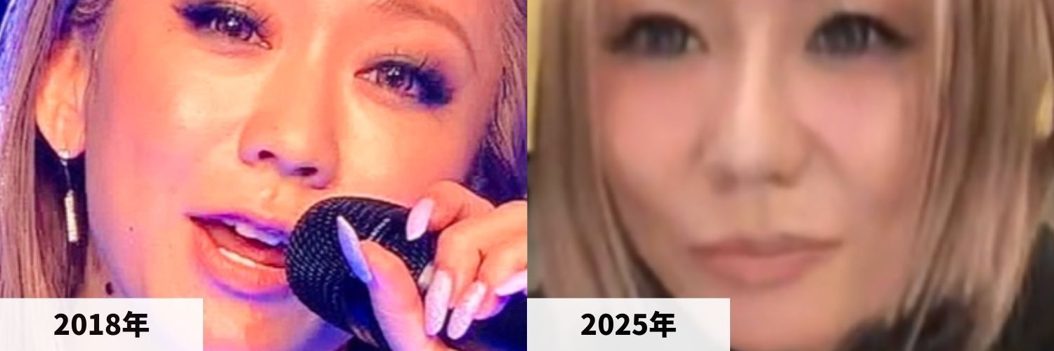 2018年と2025年の倖田來未さんの鼻の比較画像
