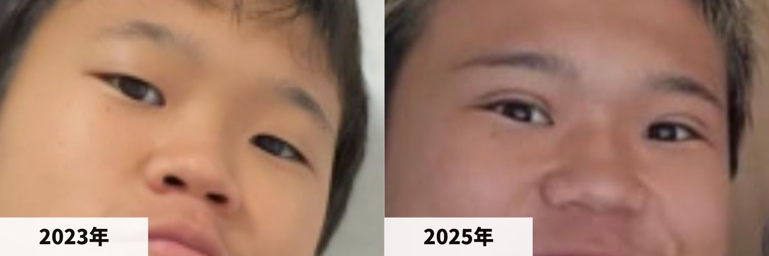 2023年と2025年のゆたぼんさんの目元の比較画像