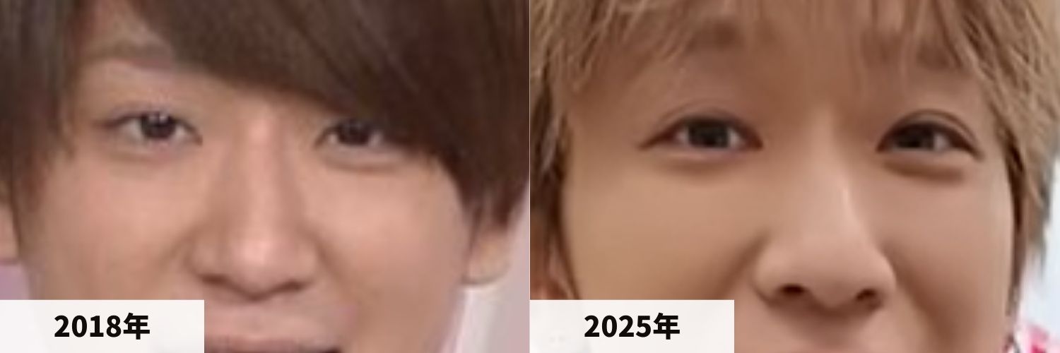 2018年と2025年の小山慶一郎さんの目と鼻の比較画像