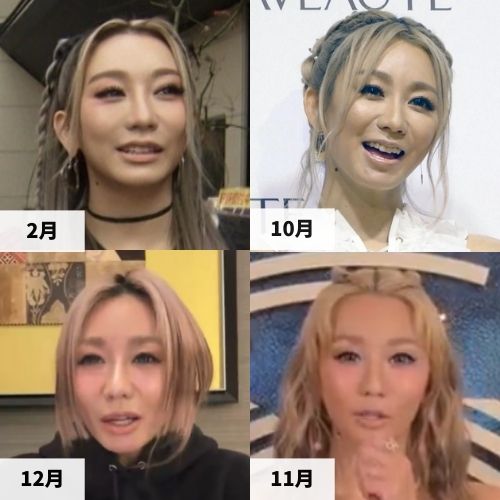 2025年の倖田來未さんの顔の比較画像