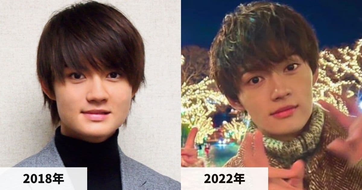 2018年と2022年の佐野勇斗さんの顔の比較画像