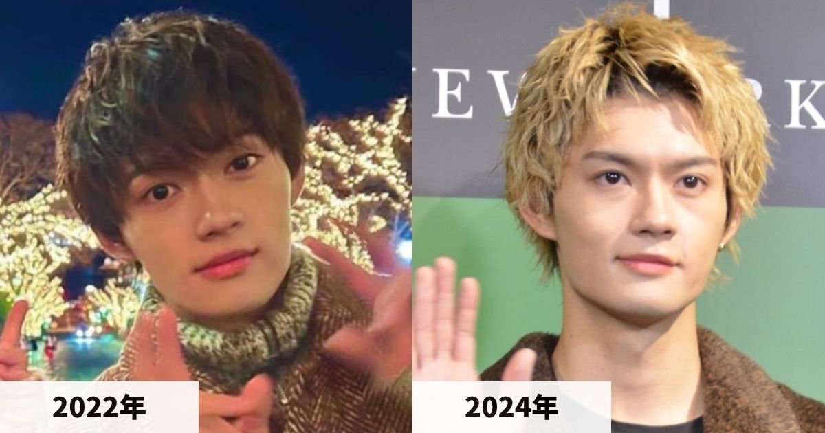 2022年と2024年の佐野勇斗さんの顔の比較画像
