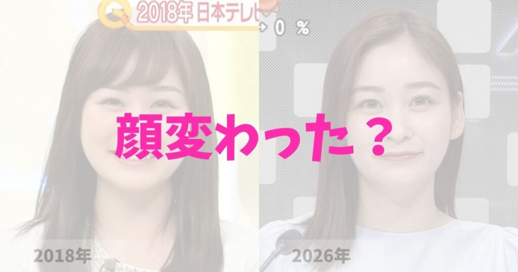 岩田絵里奈アナの顔が変わったと話題!目や鼻の整形疑惑か?メイク?それとも髪型?最近の変化を徹底検証!(2026) | りょくブロラジオ日和