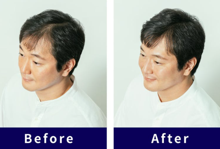 ウィッグ着用ビフォーアフター画像