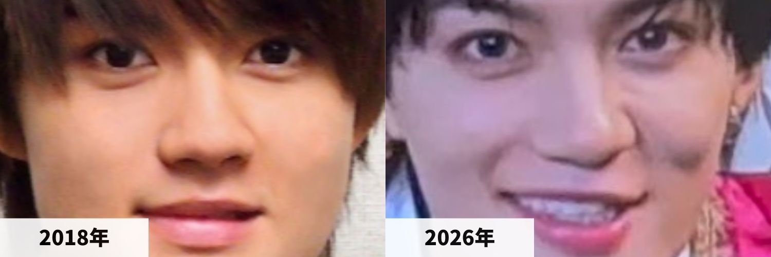 2018年と2026年の佐野勇斗さんの鼻の比較画像