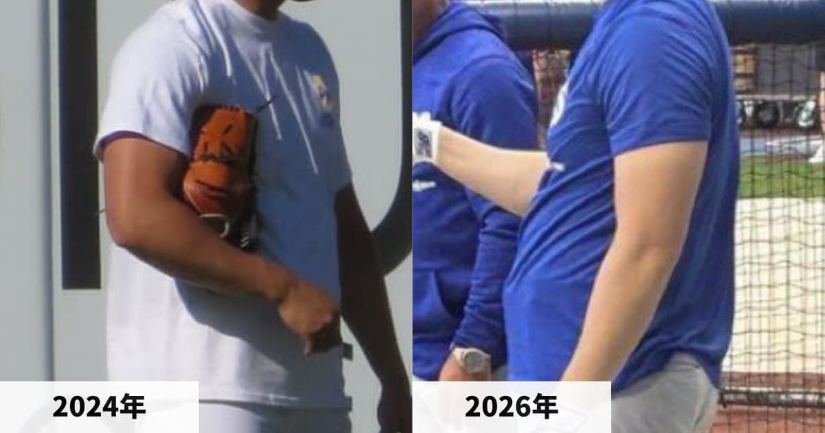 2024年と2026年の大谷翔平選手の二の腕の比較画像