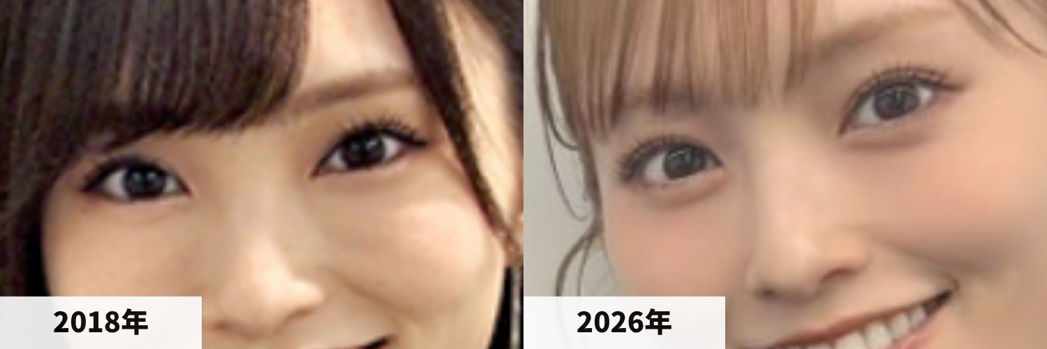 2018年と2026年の山本彩さんの目元の比較画像