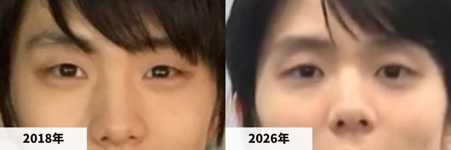 羽生結弦さんの2018年と2026年公開動画の目元の比較