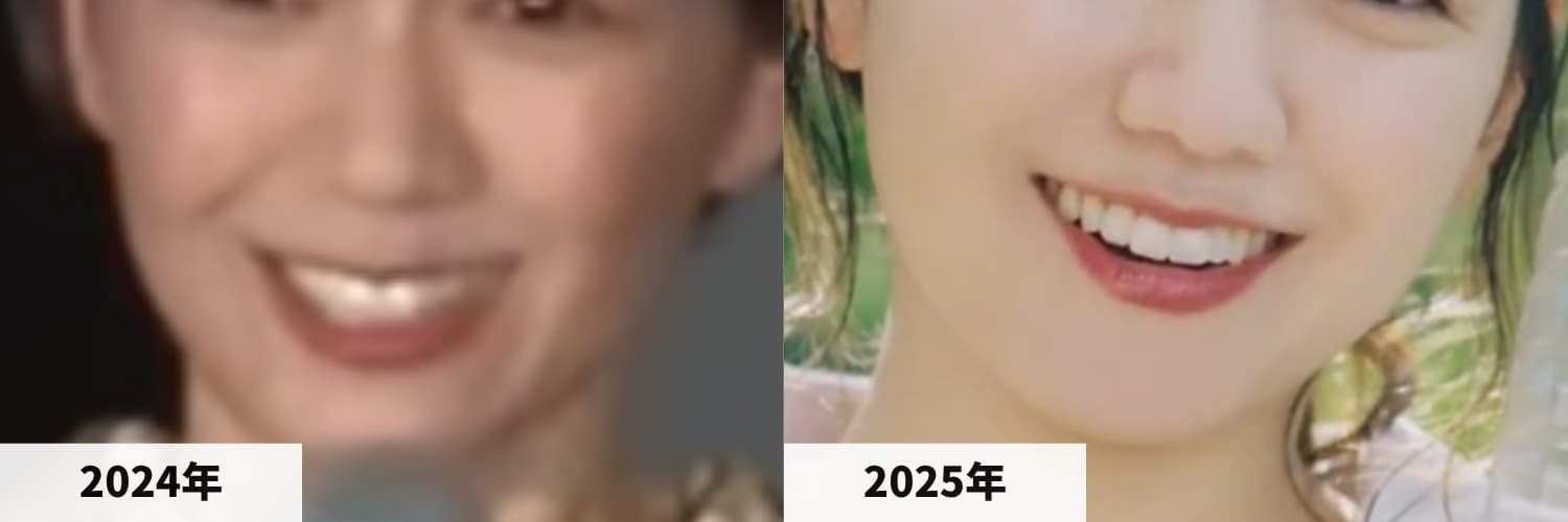 2024年と2025年の二階堂ふみさんのアゴの比較画像