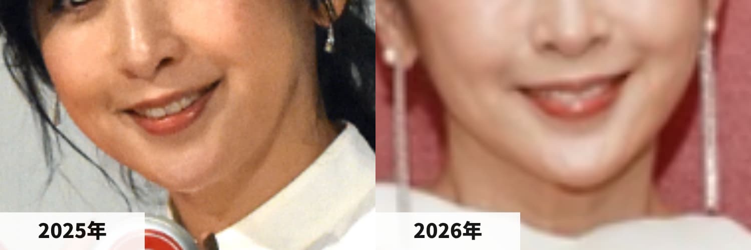2025年と2026年の斉藤由貴さんのアゴの比較画像