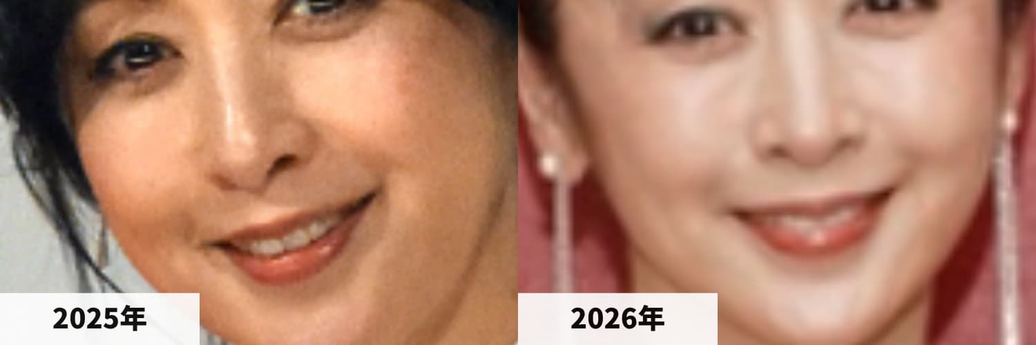 2025年と2026年の斉藤由貴さんのシワ・頬の比較画像