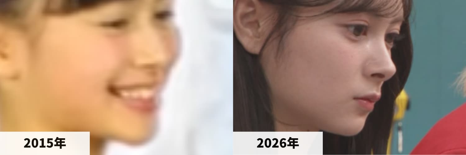 2015年のアクアビーズCM映像と2026年3月にXで公開された画像を並べた伊藤百花さんの鼻筋比較