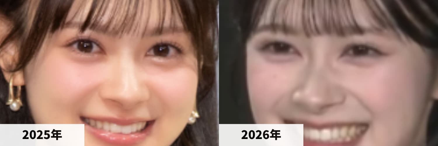 2025年と2026年の伊藤百花さんの目元の比較画像